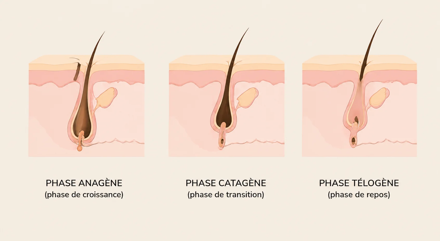 Illustration des trois phases de croissance du poil expliquant pourquoi plusieurs séances d'épilation laser sont nécessaires