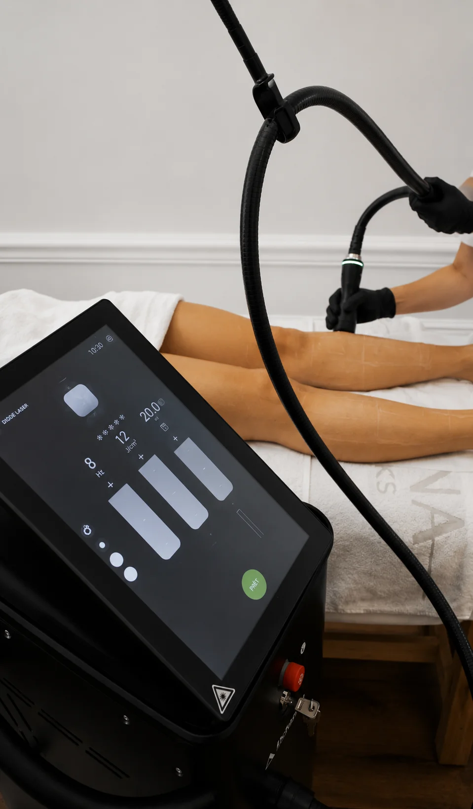 Séance d'épilation laser illustrant les conseils et le suivi après le traitement.